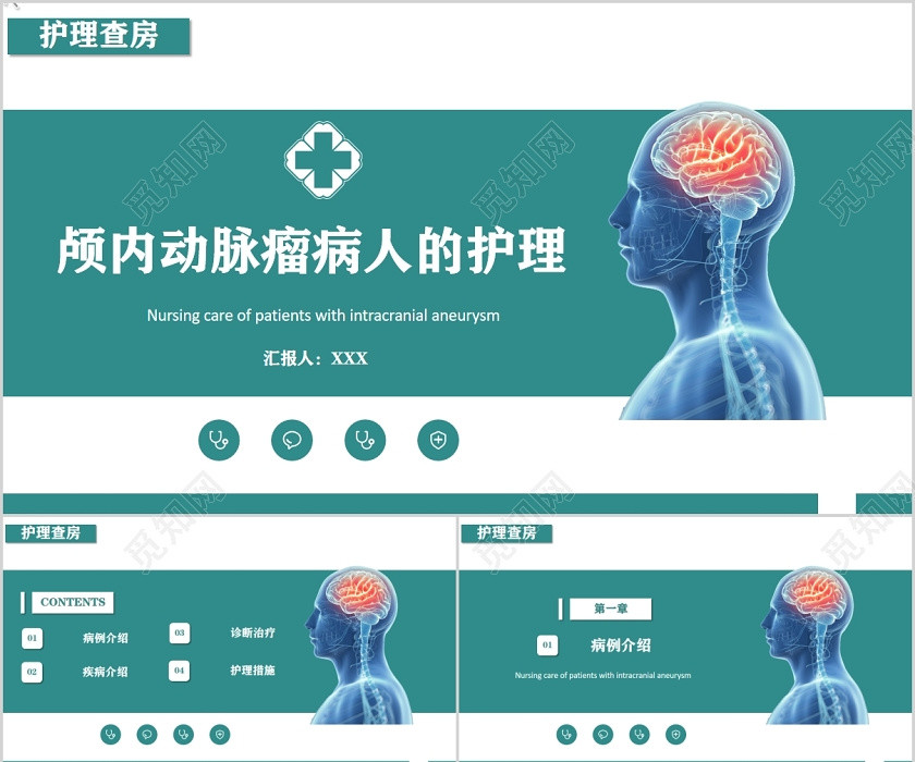 简约护理医疗颅内动脉瘤护理查房PPT模板 简约护理医疗颅内动脉瘤护理查房PPT模板