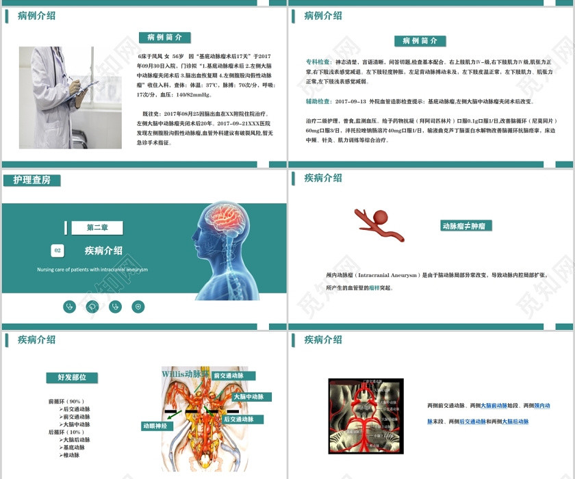 简约护理医疗颅内动脉瘤护理查房PPT模板 简约护理医疗颅内动脉瘤护理查房PPT模板